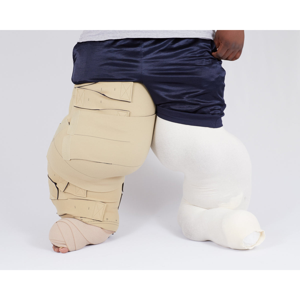 circaid reduction kit lobe – Helios Medical Equipment